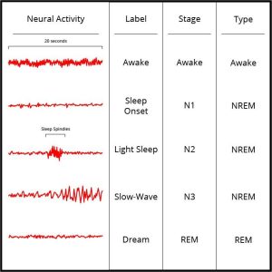 Image accompanies the previously listed stages of sleep