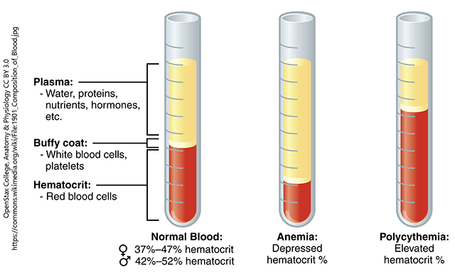 Image of blood composition for normal blood, anemic blood and polycythemia.