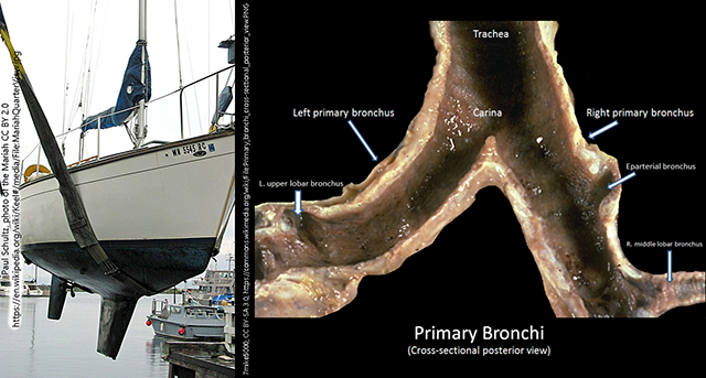 Photo of the keel of the ship "Mariah" next to a photo of the primary bronchi cross-sectional posterior view.