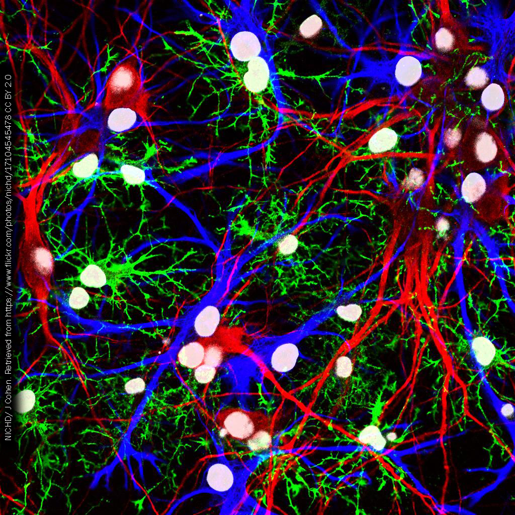 Immunofluorescence image of a brain section.