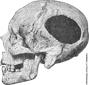 Trepanned skull from an archeological site near Nogent-les-Verges, France