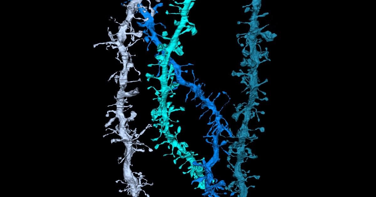 Computer reconstruction of dendritic spines.