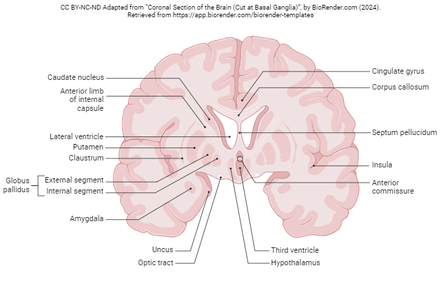 Coronal section of the brain at the level of the basal nuclei.