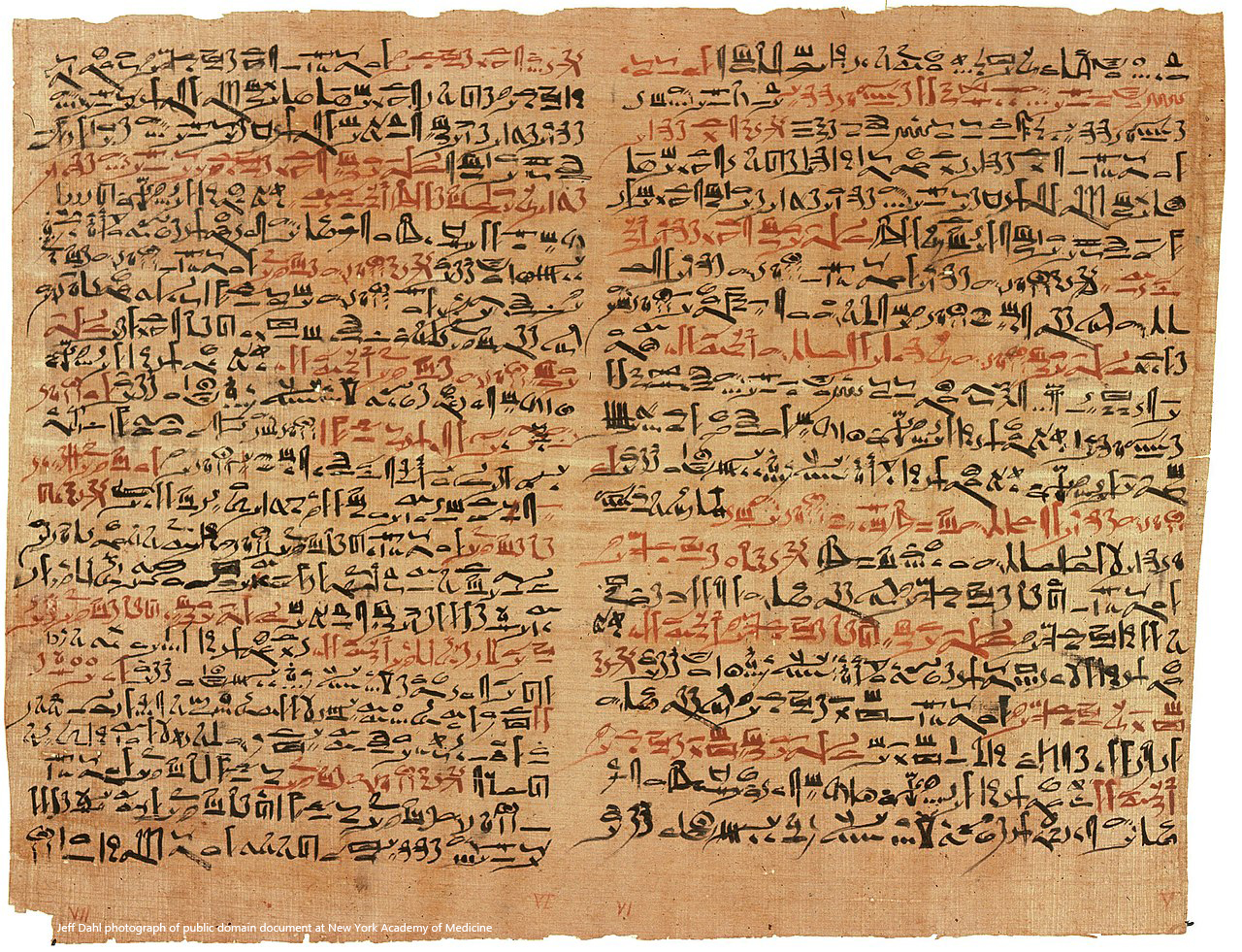 Edwin Smith surgical papyrus (1700 BCE) containing references to signs of brain surgery