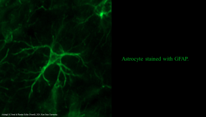 Immunofluorescence image of an astrocyte.