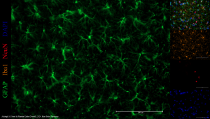 Immunofluorescence image of astrocytes.