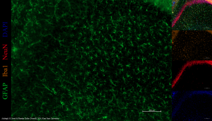 Immunofluorescence image of astrocytes.