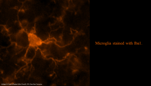 Immunofluorescence image of a microglial cell.