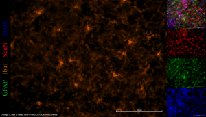 Immunofluorescence image of a microglial cell.