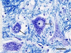 Photomicrograph of neurons in the spinal cord showing the Nissl substance.