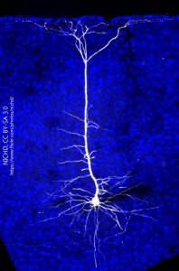 A photograph of a mouse cortical neuron.