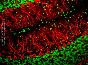 Immunofluorescence photomicrograph of Purkinje cells.