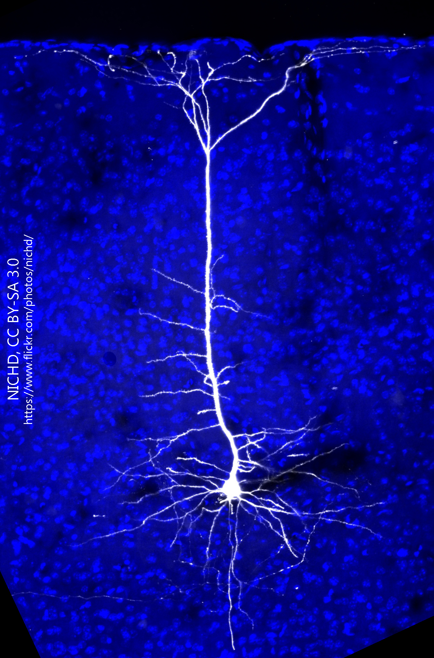 Immunofluorescence image of a mouse cortical neuron.