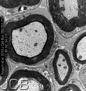 Electron micrograph of myelinated and unmyelinated axons.