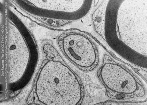 Electron micrograph of myelinated and unmyelinated axons.