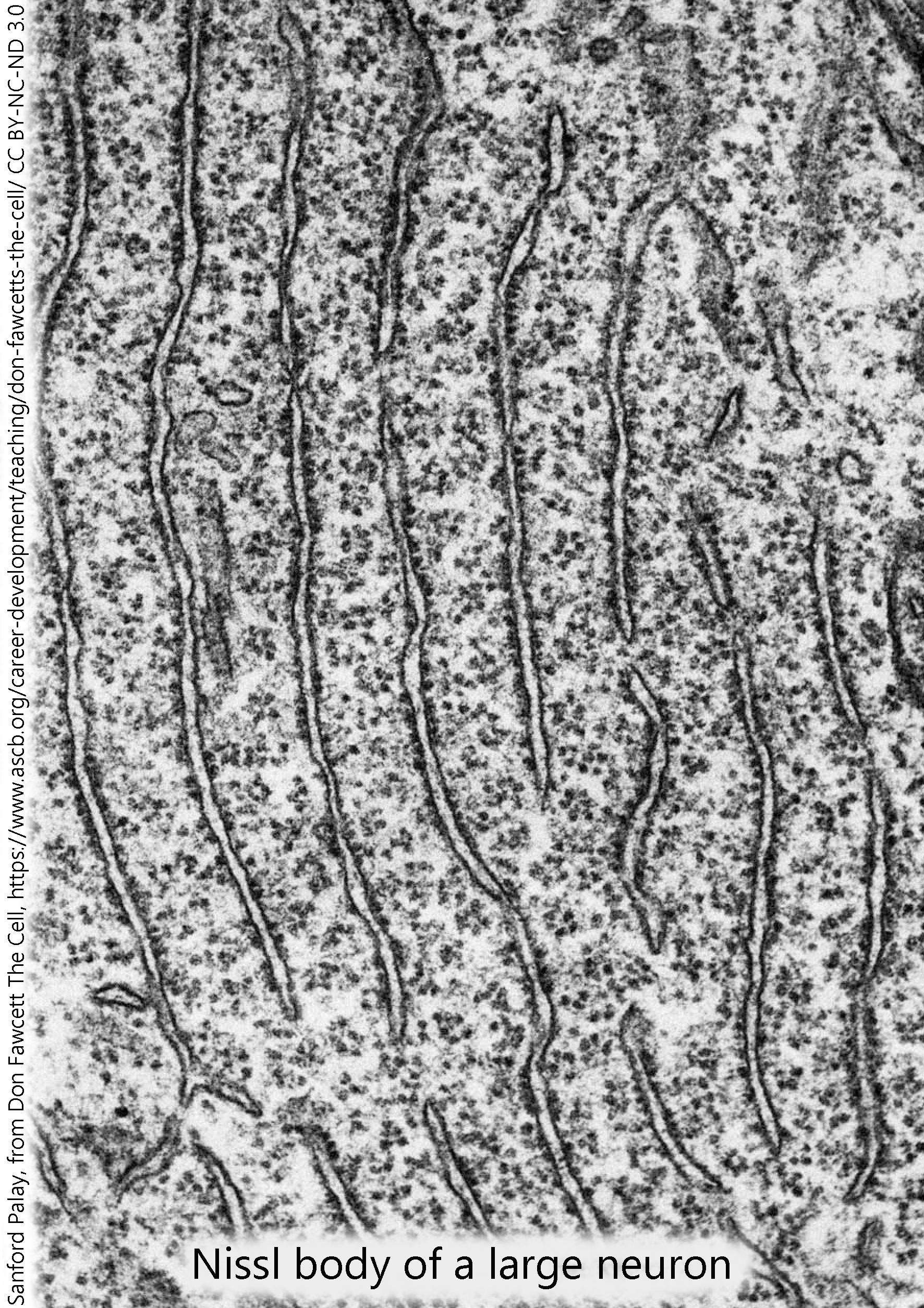 Electron micrograph of the rough endoplasmic reticulum.