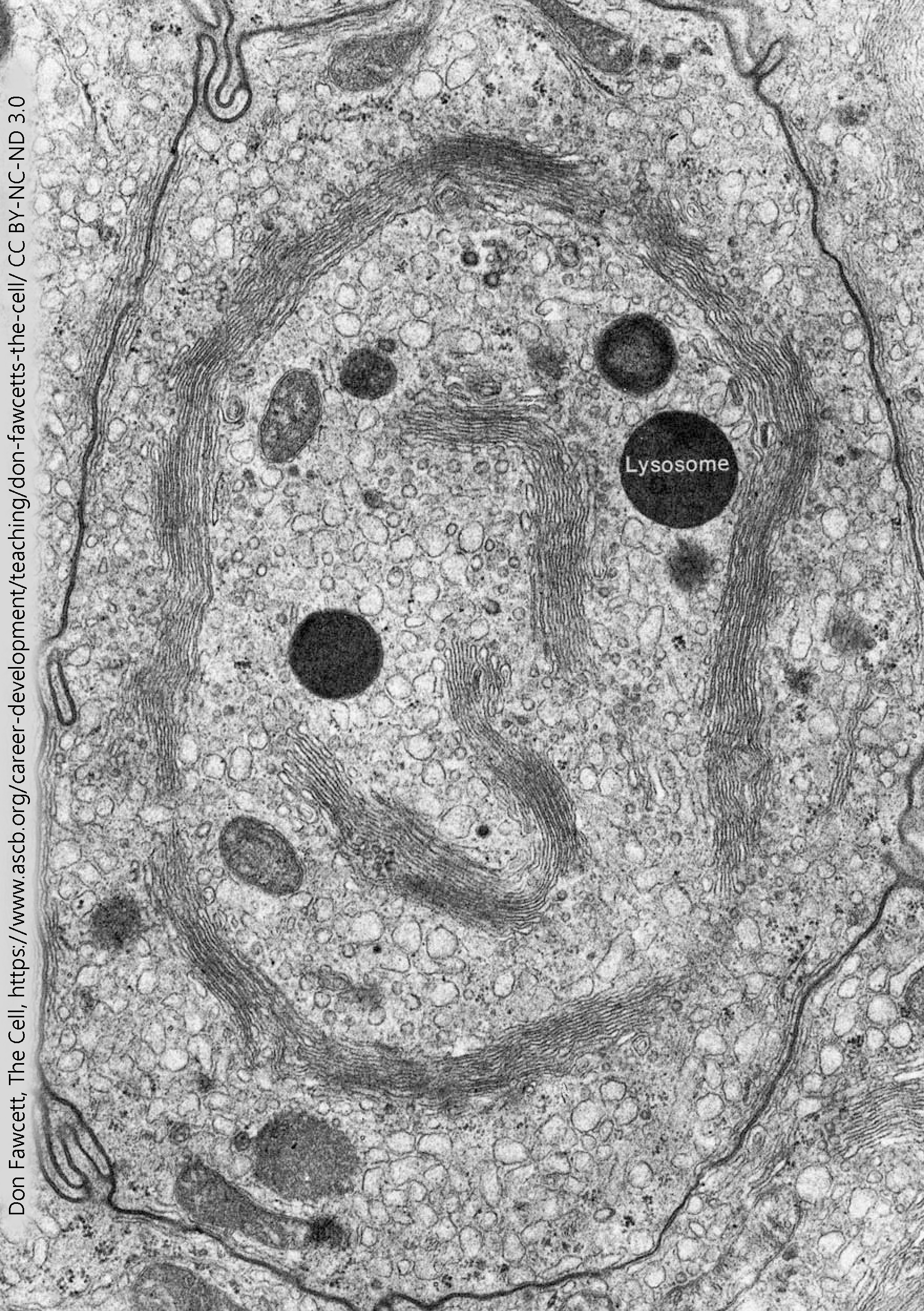 Electron micrograph of the Golgi complex.