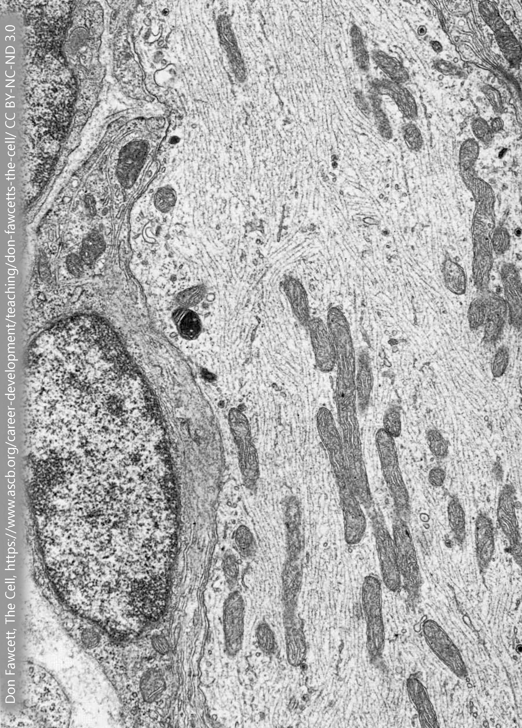 Electron micrograph of neurofilaments.