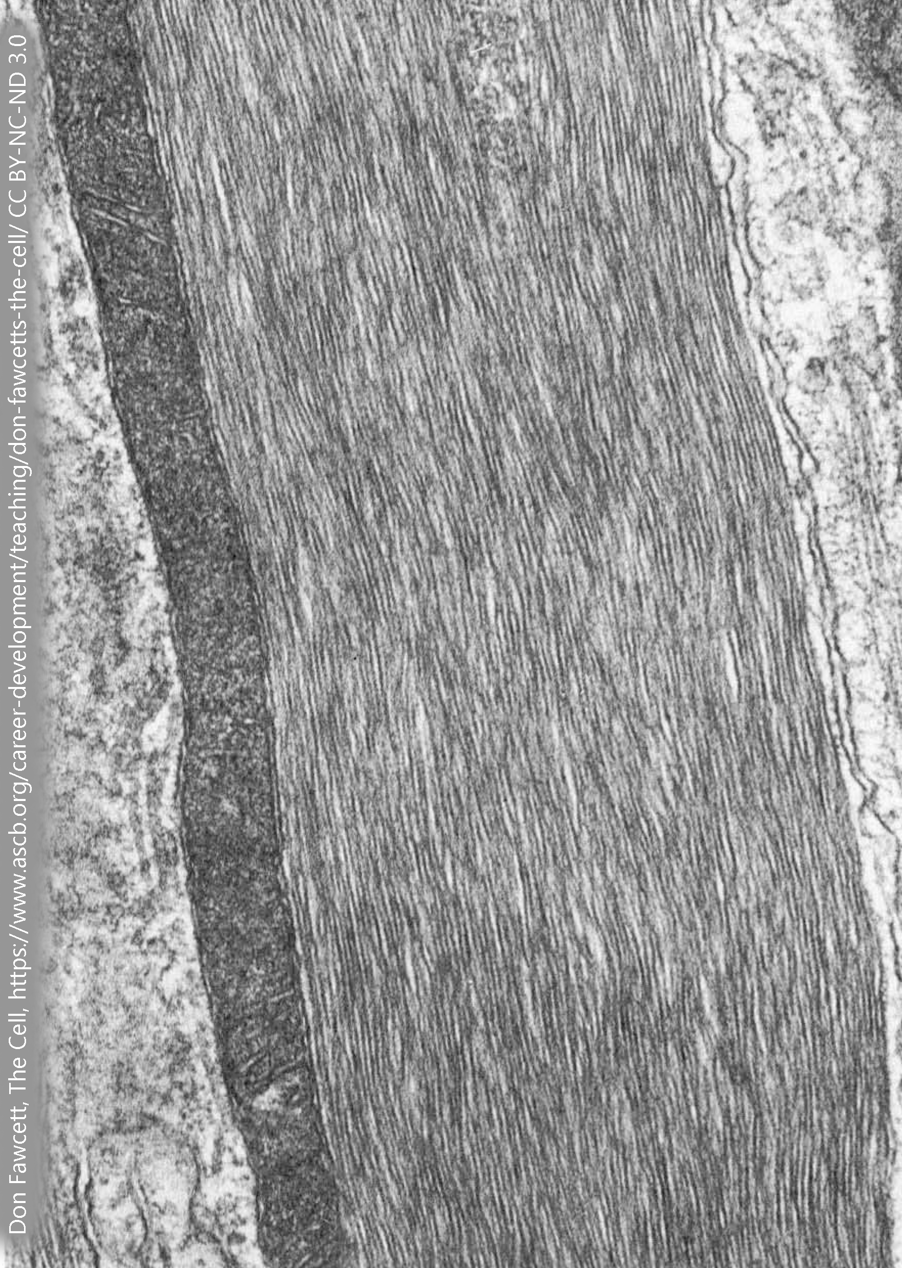 Electron micrograph of intermediate filaments.