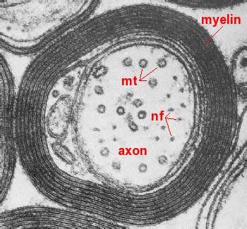 Electron micrograph of a cross-section of the nerve axon.