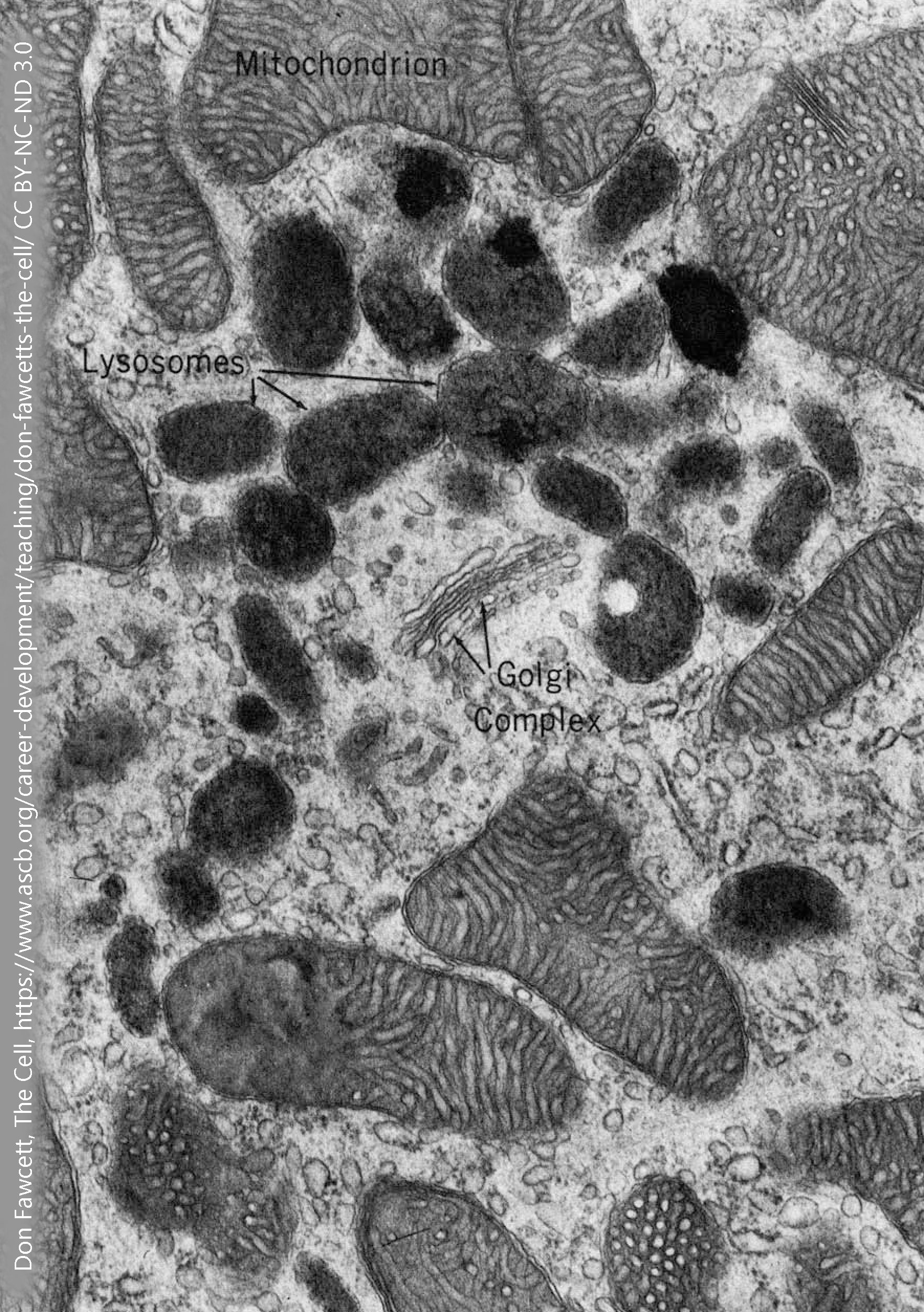 Electron micrograph of lysosomes.