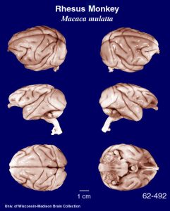 Photograph of rhesus monkey brains.