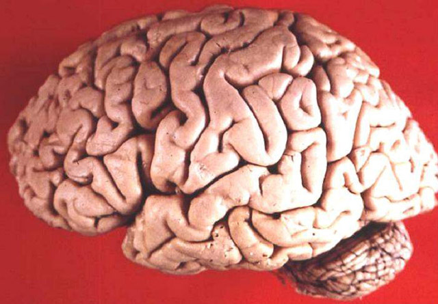 Photograph of the human brain.