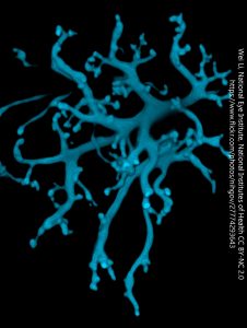 Bipolar cell dendrites in the retina.