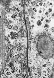 Electron micrograph of a gap junction.