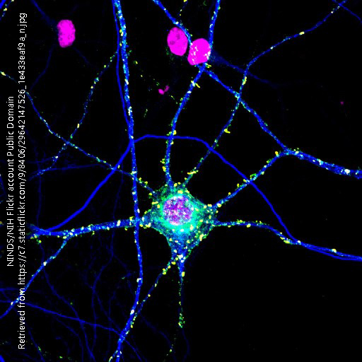 Photograph of synapses onto a neuron