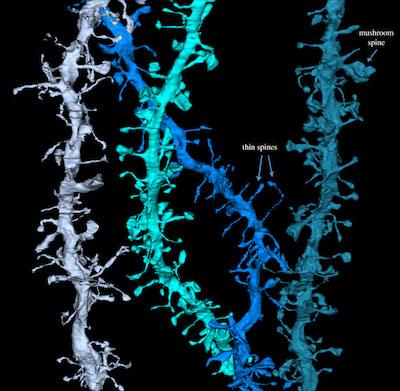 Computer reconstruction of dendritic spines.