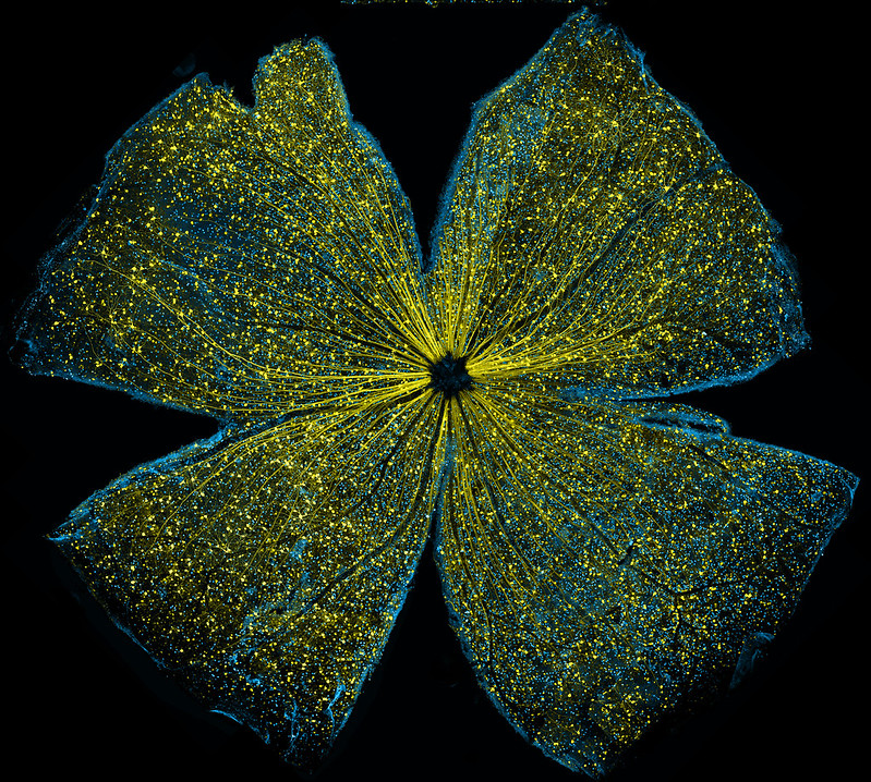 Photomicrograph of a flattened mouse retina.