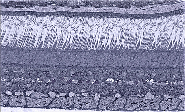 Photomicrograph of the human eye.