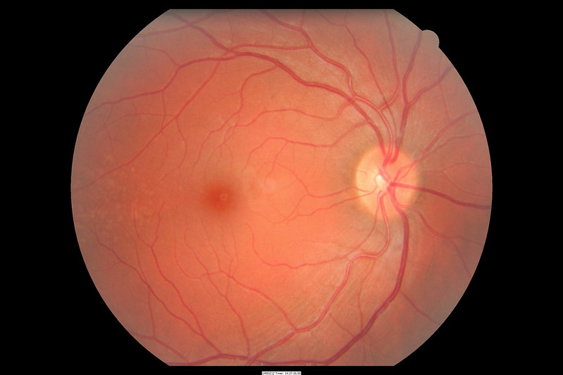 Photograph of the fundus of a human eye.