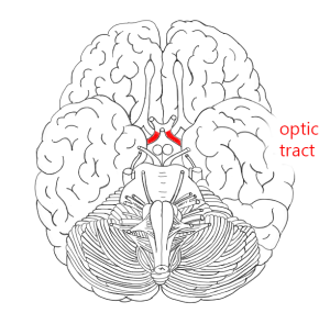 Illustration of the optic tract.