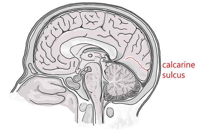 Diagram showing the location of the calcarine sulcus.