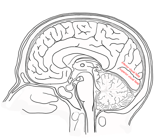 Diagram showing the upper and lower banks of the calcarine sulcus.