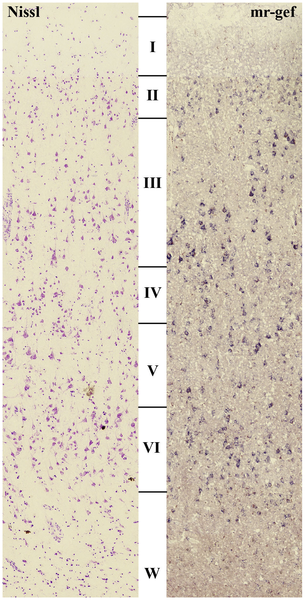 Photomicrograph of a section through cerebral cortex, with the layers labeled.