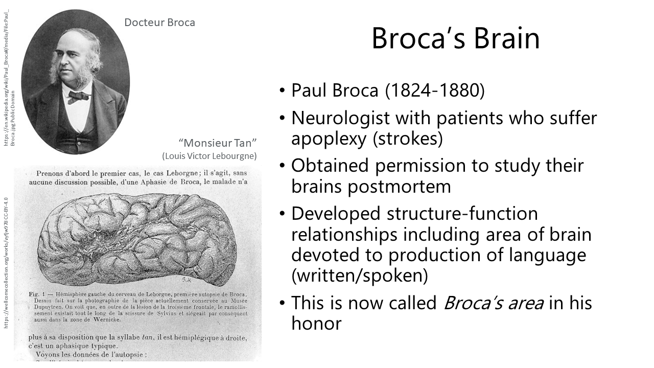 Slide illustrating how Paul Broca discovered the area of the brain named after him.