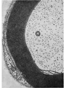 This electron micrograph is a cross section through a portion of an axon and its associated myelin wrap from the cochlear nerve of the cat.