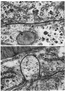 Upper: a gap junction on the boundary between two hepatic cells shows a typical narrow and straight interface. Lower: in some preparations, gap junctions appear curved, and project into one of the cells, possibly an artifact of tissue preparation.