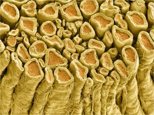 Myelinated axons in rat spinal root.