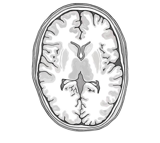 Drawing of an axial slice of the human brain.