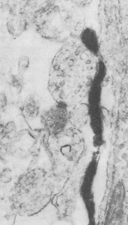 Electron microscopy showing a glial cell next to a set of developing synapses.