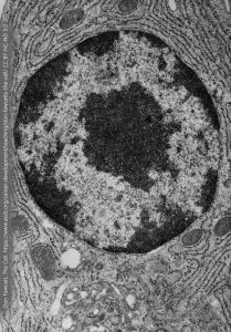 microscopic photo of a nucleus