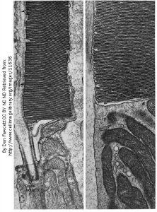 Electron micrograph of a rod photoreceptor