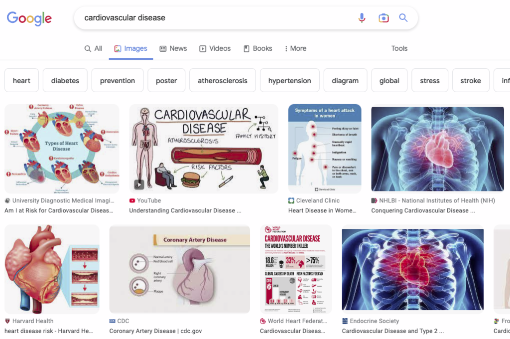 Google image results for cardiovascular disease