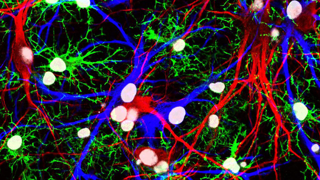 Fluorescence photomicrograph of neurons and glia.