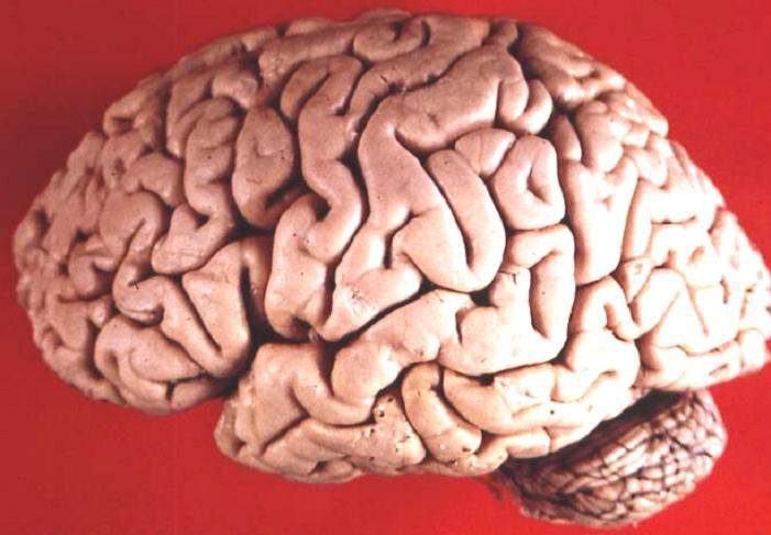 Human brain lateral view.