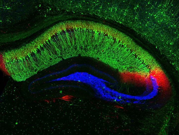 Fluorescence photomicrograph of the hippocampus, illustrating the different regions.